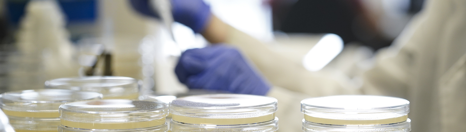 Innovación y mejora de medios de cultivo bacterianos